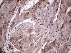 Fibronectin Antibody (OTI5C1), Novus Biologicals 0.1mL; Unlabeled:Antibodies,