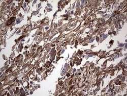 Fibronectin Antibody (OTI5C1), Novus Biologicals 0.1mL; Unlabeled:Antibodies,