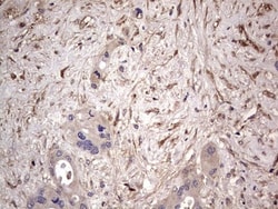 Fibronectin Antibody (OTI5C1), Novus Biologicals 0.1mL; Unlabeled:Antibodies,