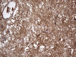 Fibronectin Antibody (OTI5C1), Novus Biologicals 0.1mL; Unlabeled:Antibodies,