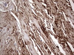 Fibronectin Antibody (OTI5C1), Novus Biologicals 0.1mL; Unlabeled:Antibodies,