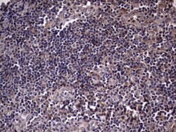 Fibronectin Antibody (OTI5C1), Novus Biologicals 0.1mL; Unlabeled:Antibodies,