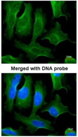 Fibronectin Antibody, Novus Biologicals 0.1mg; Unlabeled:Antibodies, Polyclonal
