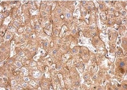 Fibronectin Antibody, Novus Biologicals 0.1mg; Unlabeled:Antibodies, Polyclonal