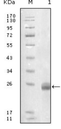 Fibulin 5/DANCE Antibody (1G6A4), Novus Biologicals 0.025 mL | Buy Online | Novus Biologicals | Fisher Scientific