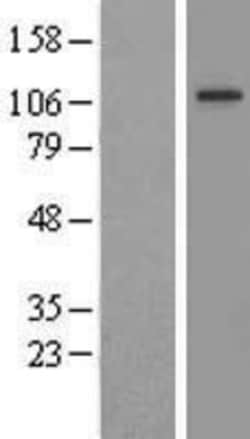 Novus Biologicals&trade;&nbsp;FIG4 Overexpression Lysate