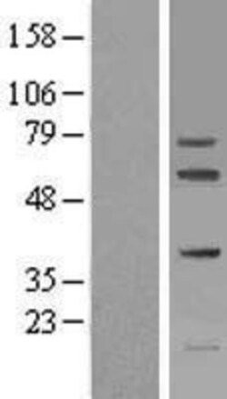 Novus Biologicals&trade;&nbsp;FIGNL1 Overexpression Lysate