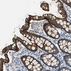 Filamin B Antibody, Novus Biologicals 0.1mL; Unlabeled:Antibodies, Polyclonal