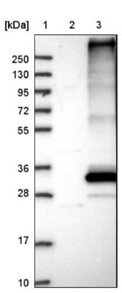 FITM1 Antibody, Novus Biologicals 0.1mL; Unlabeled:Antibodies, Polyclonal