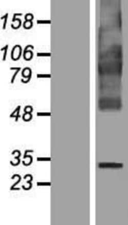 Novus Biologicals&trade;&nbsp;FITM1 Overexpression Lysate