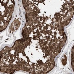 FITM1 Antibody, Novus Biologicals 0.1mL; Unlabeled:Antibodies, Polyclonal