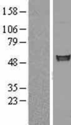 Novus Biologicals&trade;&nbsp;FIZ1 Overexpression Lysate