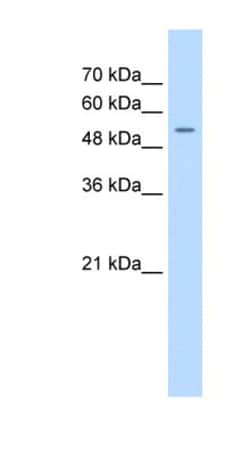 FJX1 Antibody, Novus Biologicals 100&mu;L; Unlabeled:Antibodies, Polyclonal