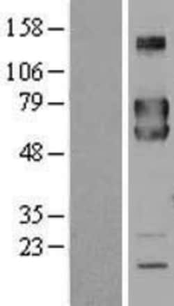 Novus Biologicals&trade;&nbsp;FKBP10 Overexpression Lysate