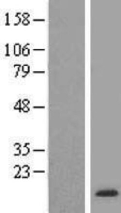 Novus Biologicals&trade;&nbsp;FKBP12 Overexpression Lysate