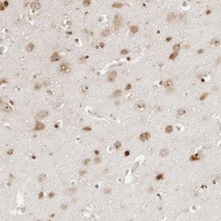 FKBP14 Antibody, Novus Biologicals 25 &mu;L | Buy Online | Novus Biologicals | Fisher Scientific