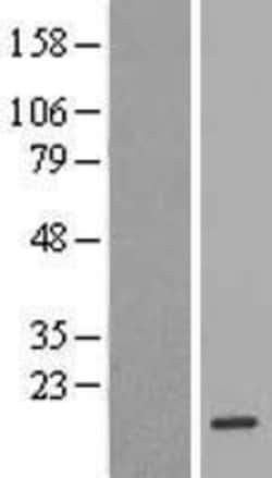 Novus Biologicals&trade;&nbsp;FKBP13/FKBP2 Overexpression Lysate