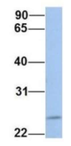 FKBP25 Antibody, Novus Biologicals 100&mu;L; Unlabeled:Antibodies, Polyclonal