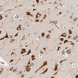 FKBP25 Antibody, Novus Biologicals:Antibodies:Primary Antibodies