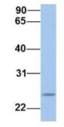 FKBP25 Antibody, Novus Biologicals 100&mu;L; Unlabeled:Antibodies, Polyclonal