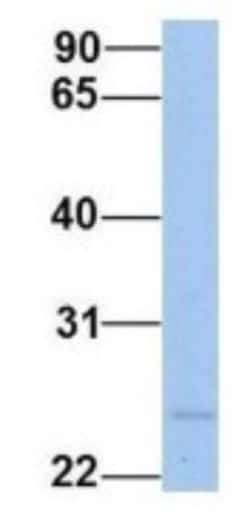 FKBP25 Antibody, Novus Biologicals 100&mu;L; Unlabeled:Antibodies, Polyclonal