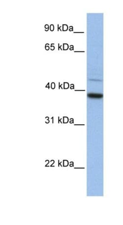 FKBP38 Antibody, Novus Biologicals 100 &mu;L | Buy Online | Novus Biologicals | Fisher Scientific