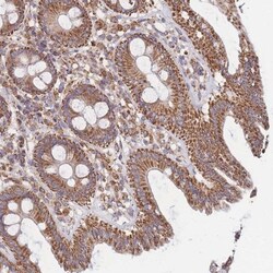 FKBP38 Antibody, Novus Biologicals 0.1mL; Unlabeled:Antibodies, Polyclonal