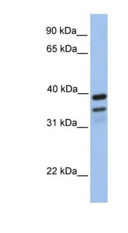 FKBP38 Antibody, Novus Biologicals:Antibodies:Primary Antibodies