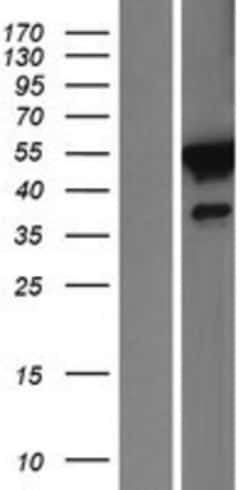Novus Biologicals&trade;&nbsp;FKBP51/FKBP5 Overexpression Lysate