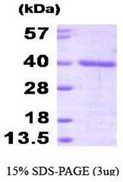 Novus Biologicals&trade;&nbsp;Recombinant Human FKBP6 His Protein