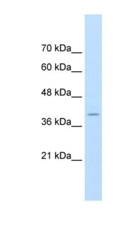 FKBP6 Antibody, Novus Biologicals:Antibodies:Primary Antibodies