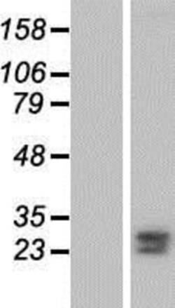 Novus Biologicals&trade;&nbsp;FKBP7 Overexpression Lysate