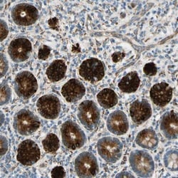 FKBP7 Antibody, Novus Biologicals 25 &mu;L; Unlabeled:Antibodies, Polyclonal