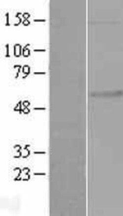 Novus Biologicals&trade;&nbsp;FKRP Overexpression Lysate