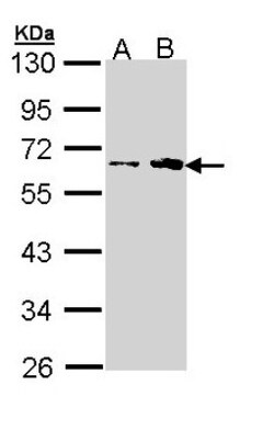 FKTN Antibody, Novus Biologicals 0.1mg; Unlabeled:Antibodies, Polyclonal