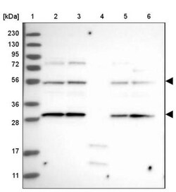 FLAD1 Antibody, Novus Biologicals 0.1mL; Unlabeled:Antibodies, Polyclonal