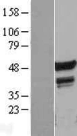 Novus Biologicals&trade;&nbsp;FLI1 Overexpression Lysate