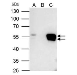 FLI1 Antibody, Novus Biologicals 0.1mL; Unlabeled:Antibodies, Polyclonal