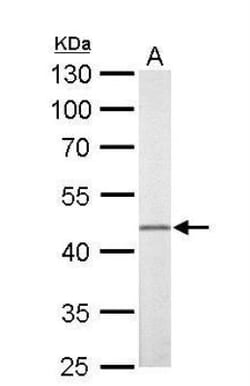 FLI1 Antibody, Novus Biologicals 0.1mL; Unlabeled:Antibodies, Polyclonal