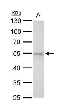 FLI1 Antibody, Novus Biologicals 0.1mL; Unlabeled:Antibodies, Polyclonal