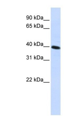 FLJ10769 Antibody, Novus Biologicals 100 &mu;L | Buy Online | Novus Biologicals | Fisher Scientific