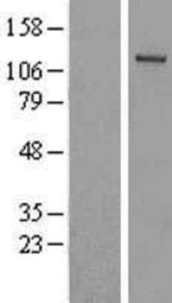 Novus Biologicals&trade;&nbsp;FLJ10808 Overexpression Lysate