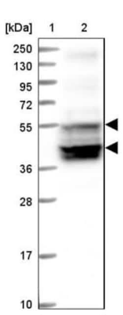 FLJ10815 Antibody, Novus Biologicals 0.1mL; Unlabeled:Antibodies, Polyclonal