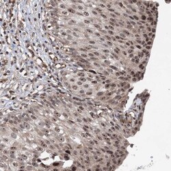 FLJ11184 Antibody, Novus Biologicals 0.1mL; Unlabeled:Antibodies, Polyclonal