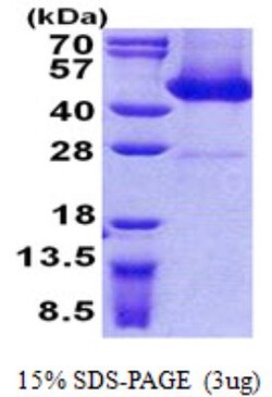 Novus Biologicals&trade;&nbsp;Recombinant Human FLJ11506 His Protein