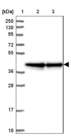 FLJ11506 Antibody, Novus Biologicals 0.1mL; Unlabeled:Antibodies, Polyclonal