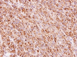 FLJ13946 Antibody, Novus Biologicals 0.1mg; Unlabeled:Antibodies, Polyclonal