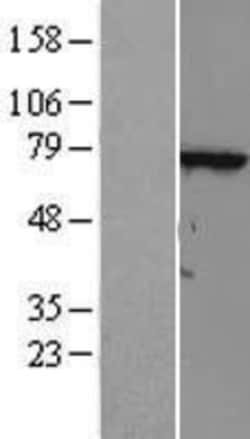 Novus Biologicals™ FLJ13946 Overexpression Lysate