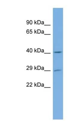 FLJ14154 Antibody, Novus Biologicals:Antibodies:Primary Antibodies