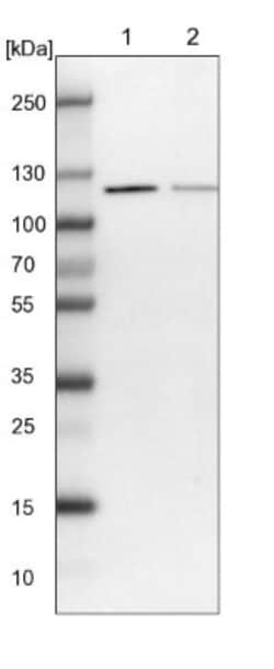 VPS50 Antibody, Novus Biologicals 0.1mL; Unlabeled:Antibodies, Polyclonal